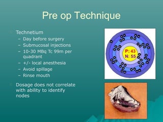 Pre op Technique
Technetium
– Day before surgery
– Submucosal injections
– 10-30 MBq Tc 99m per
quadrant
– +/- local anesthesia
– Avoid spillage
– Rinse mouth
Dosage does not correlate
with ability to identify
nodes
 
