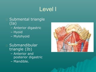 Marginal Mandibular Nerve
Most commonly injury
dissection level Ib
Landmarks:
– 1cm anterior and inferior
to angle of mand...