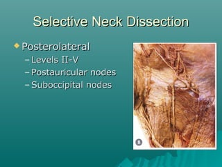Neck dissection-slides-060920 | PPT
