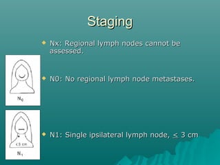 StagingStaging
 N2a: Single ipsilateral lymph node 3 toN2a: Single ipsilateral lymph node 3 to
6 cm6 cm
 N2b: Multiple i...