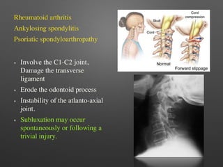 Neck and back pain | PDF