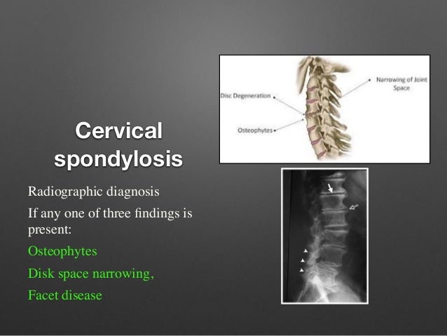 Neck and back pain