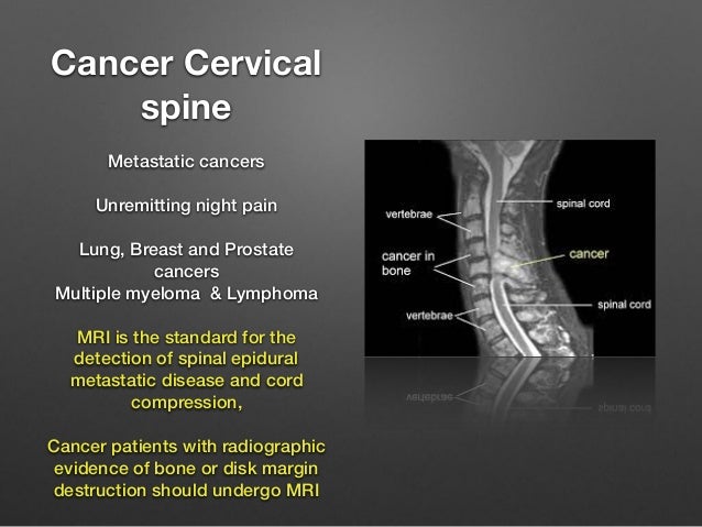 Neck and back pain