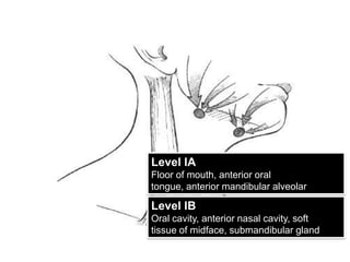 Level IAFloor of mouth, anterior oral tongue, anterior mandibularalveolar ridge, lower lipLevel IBOral cavity, anterior nasal cavity, softtissue of midface, submandibular gland