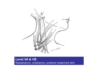 Level VA & VBNasopharynx, oropharynx, posterior scalp/neck skin