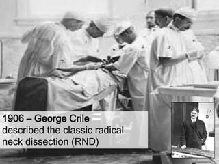 1906 – George Criledescribed the classic radical neck dissection (RND)