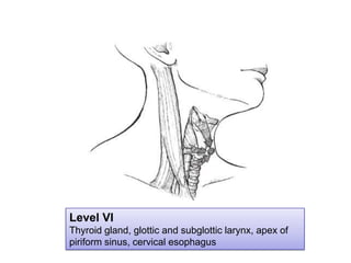 Level VI<br />Thyroid gland, glottic and subglotticlarynx, apex of piriform sinus, cervical esophagus<br />