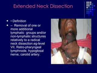  • Definition
 – Removal of one or
more additional
lymphatic groups and/or
non-lymphatic structures
relatively to a radical
neck dissection.eg-level
VII, Retro-pharyngeal
lymphnode, hypoglosal
nerve, carotid artery.
 