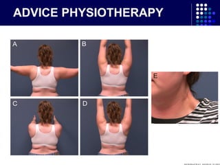 ADVICE PHYSIOTHERAPY
 