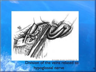 Division of the veins related to
hypoglossal nerve 73
 