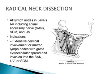  All lymph nodes in Levels
I-V including spinal
accessory nerve (SAN),
SCM, and IJV
 Indications
 – Extensive cervical
involvement or matted
lymph nodes with gross
extracapsular spread and
invasion into the SAN,
IJV, or SCM
 