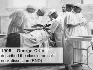 1906 – George Crile
described the classic radical
neck dissection (RND)
 