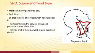 SND: Supraomohyoid type
• Most commonly performed SND
• Definition
– En bloc removal of cervical lymph node groups I-
III
...