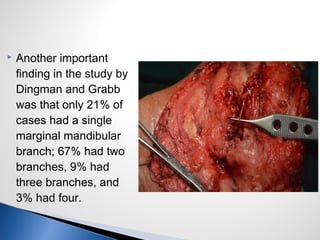  Another important
finding in the study by
Dingman and Grabb
was that only 21% of
cases had a single
marginal mandibular
branch; 67% had two
branches, 9% had
three branches, and
3% had four.
 