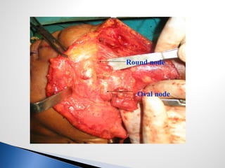 Round node
Oval node
 