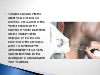  A needle is passed into the
target mass and cells are
aspirated. The success of this
method depends on the
accuracy of needle placement
and the reliability of the
diagnosis, on the skill and
experience of the pathologist.
When it is combined with
ultrasonography it is a highly
accurate technique for the
investigation of cervical lymph
node metastasis.
 