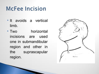  It avoids a vertical
limb.
 Two horizontal
incisions are used
one in submandibular
region and other in
the suprascapular
region.
 