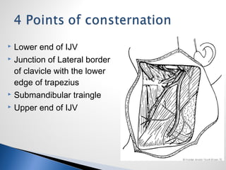  Lower end of IJV
 Junction of Lateral border
of clavicle with the lower
edge of trapezius
 Submandibular traingle
 Upper end of IJV
 
