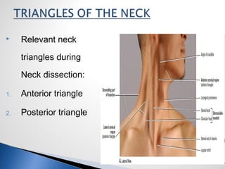  Relevant neck
triangles during
Neck dissection:
1. Anterior triangle
2. Posterior triangle
 