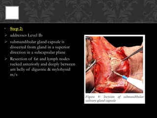 • Step 4:
 fatty tissue in Level II dissected
 XIn which may course lateral,
medial or very rarely through IJV
identifie...