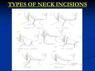 TYPES OF NECK INCISIONS
 