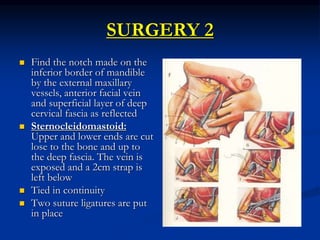 SURGERY 2
 Find the notch made on the
inferior border of mandible
by the external maxillary
vessels, anterior facial vein
and superficial layer of deep
cervical fascia as reflected
 Sternocleidomastoid:
Upper and lower ends are cut
lose to the bone and up to
the deep fascia. The vein is
exposed and a 2cm strap is
left below
 Tied in continuity
 Two suture ligatures are put
in place
 