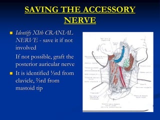 SAVING THE ACCESSORY
NERVE
 Identify XIth CRANIAL
NERVE - save it if not
involved
If not possible, graft the
posterior auricular nerve
 It is identified ⅓rd from
clavicle, ⅔rd from
mastoid tip
 