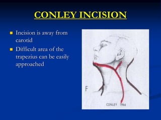 SAVING THE ACCESSORY
NERVE
 Identify XIth CRANIAL
NERVE - save it if not
involved
If not possible, graft the
posterior au...