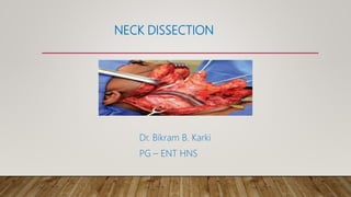 NECK DISSECTION
Dr. Bikram B. Karki
PG – ENT HNS
 