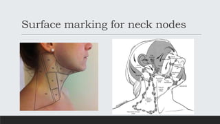 Surface marking for neck nodes
 