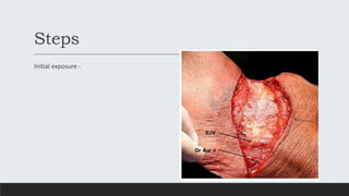 Steps
Initial exposure -
 