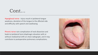Cont…
Hypoglossal nerve - injury result in ipsilateral tongue
weakness, deviation of the tongue to the affected side
and difficulty with speech and swallowing
Phrenic nerve-rare complication of neck dissection and
leads to ipsilateral hemi-diaphragm elevation with or
without mediastinal shift on chest radiograph, and it may
contribute to postoperative pulmonary complications.
 
