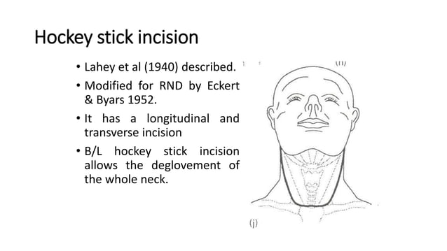 Neck Dissection Incision Apron Neck Dissection.pptx