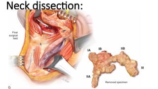 Neck Dissection Incision Apron NECK DISSECTION current protocol/management of neck .pptx