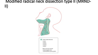Neck Dissection Rcpa NECK DISSECTION current protocol/management of neck .pptx