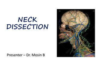 NECK
DISSECTION
Presenter – Dr. Mosin B
 