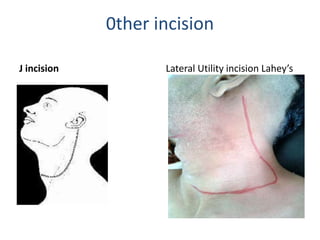 Lahey Incision NECK DISSECTION- A COMPREHENSIVE STUDY | PPTX