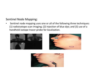 Neck dissectionppt.pptx