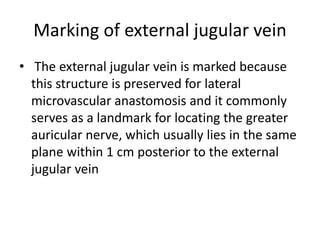 Marking of external jugular vein
• The external jugular vein is marked because
this structure is preserved for lateral
mic...