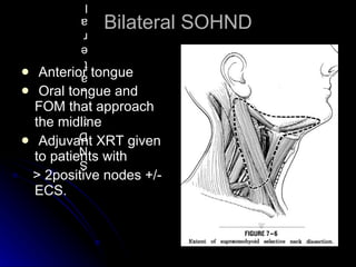 Bilateral SOHND <ul><li>Anterior tongue </li></ul><ul><li>Oral tongue and FOM that approach the midline </li></ul><ul><li>...