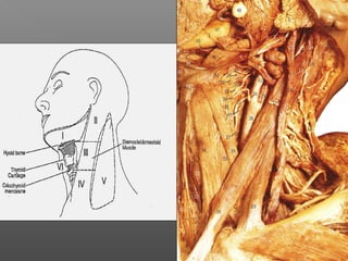 Neck dissections | PPT