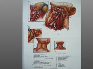 Neck Dissection Rcpa Neck dissections | PPT