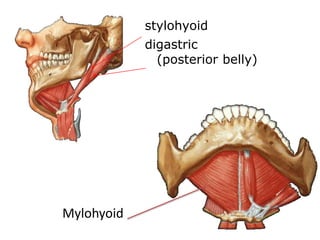 • Why we remove submandibular gland in neck
dissection?
 