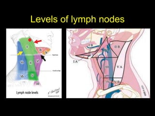 Levels of lymph nodes
 