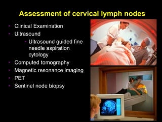 Assessment of cervical lymph nodes
• Clinical Examination
• Ultrasound
• Ultrasound guided fine
needle aspiration
cytology...