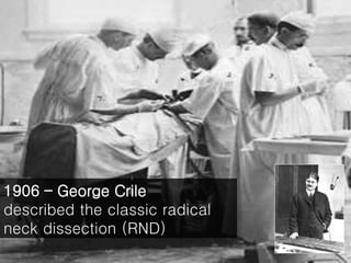 1906 – George Crile
described the classic radical
neck dissection (RND)
 