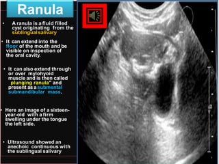 Neck Imaging.pptx