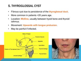 5. THYROGLOSSAL CYST
• Fibrous cyst due to persistence of the thyroglossal duct.
• More common in patients <20 years age.
• Location: Midline, usually between hyoid bone and thyroid
isthmus.
• Movement: Upwards with tongue protusion.
• May be painful if infected.
 