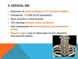 9. CERVICAL RIB
• Extension of costo-cartilage on 7th cervical vertebra.
• Prevalence: 1 in 500 (0.2% population).
• More common in adult females.
• 10% develop thoracic outlet syndrome.
• Also compression of brachial plexus and subclavian
artery.
• Abson’s sign: Loss of radial pulse on arm abduction
and external rotation.
 