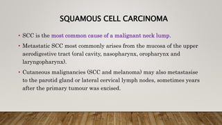SQUAMOUS CELL CARCINOMA
• SCC is the most common cause of a malignant neck lump.
• Metastatic SCC most commonly arises from the mucosa of the upper
aerodigestive tract (oral cavity, nasopharynx, oropharynx and
laryngopharynx).
• Cutaneous malignancies (SCC and melanoma) may also metastasise
to the parotid gland or lateral cervical lymph nodes, sometimes years
after the primary tumour was excised.
 